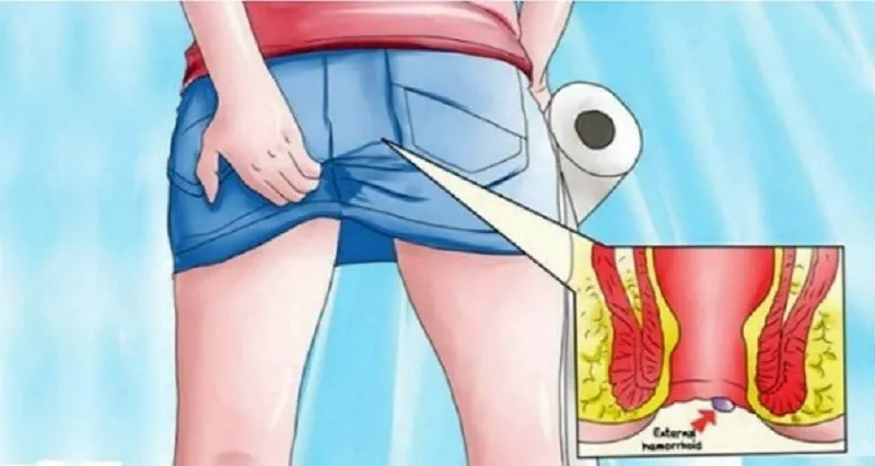 Hemokeys : komposisi hanya bahan-bahan alami.